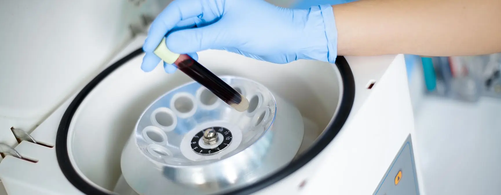 Doctor at a medical office preparing for a BMAC Injection.