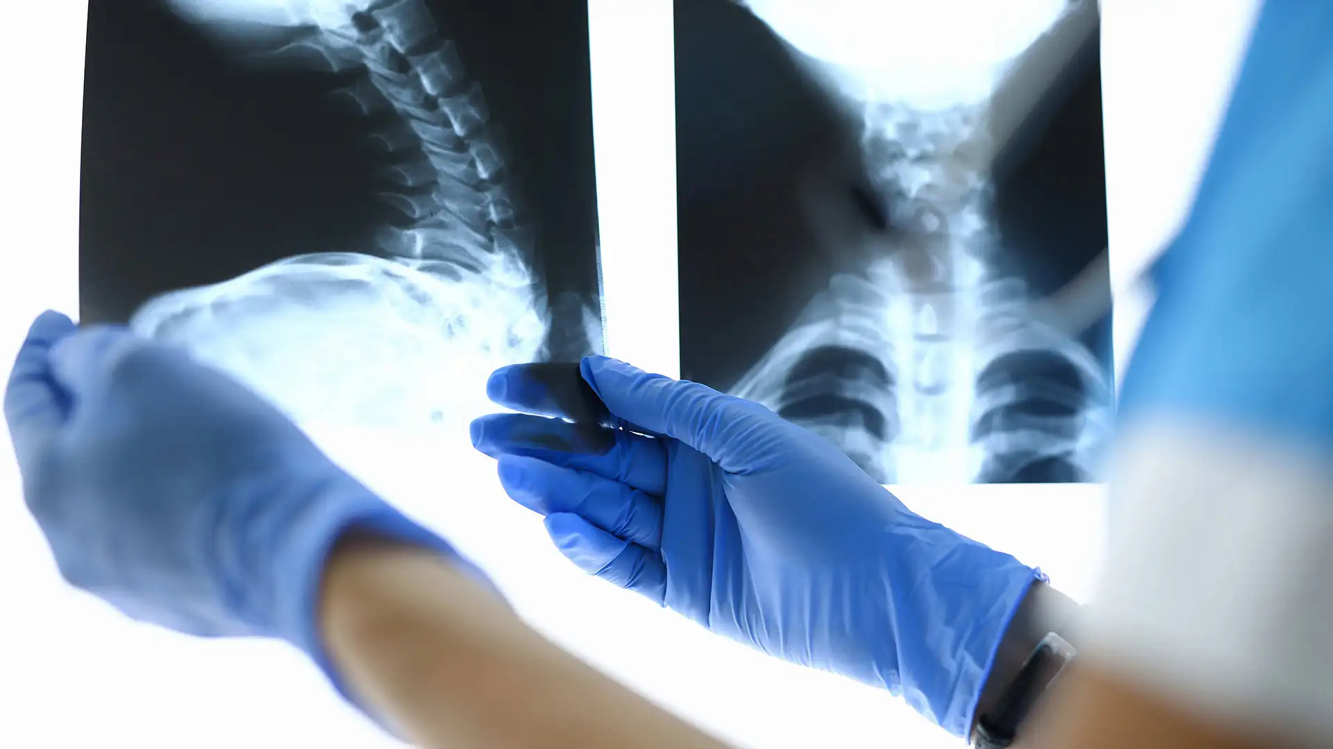 Doctor examining cervical spine X-ray