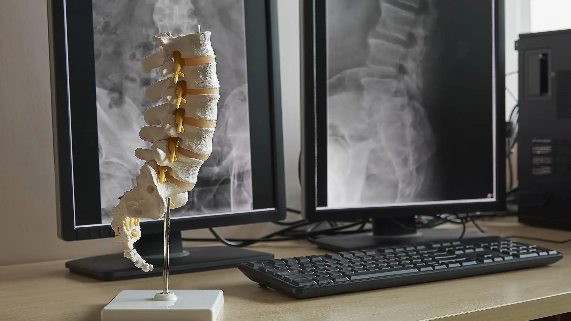 Artificial human lumbar spine model on the table with display monitor of lumbar spine x-rays