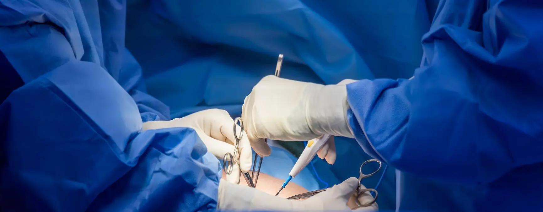 spinal cord stimulation (SCS) and dorsal root ganglion (DRG) trial procedures