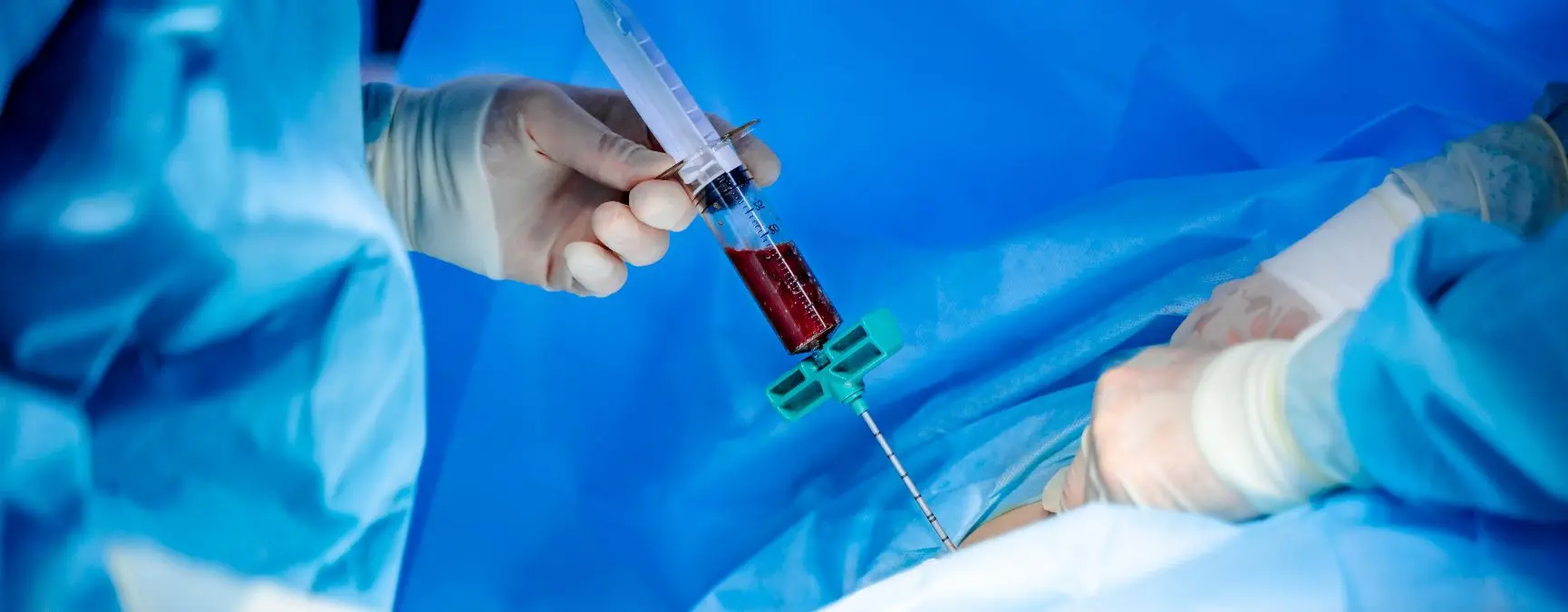 Person at a medical clinic receiving a stem cell bone marrow harvesting injection.