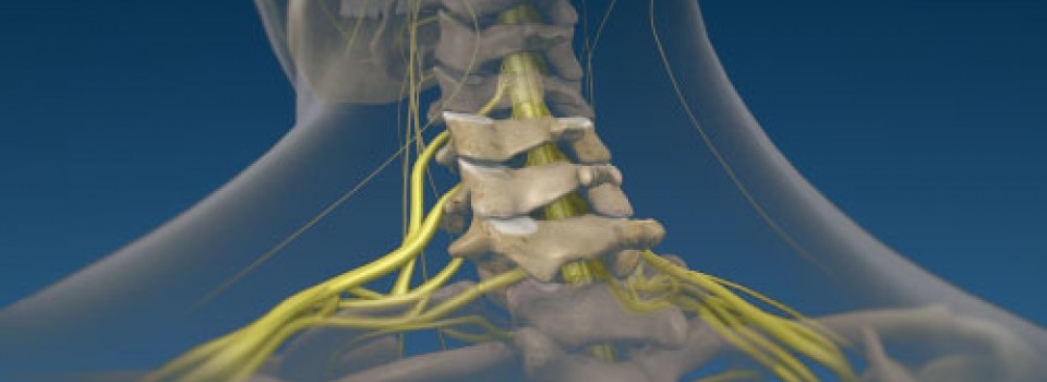 cervical_radiculopathy_blue
