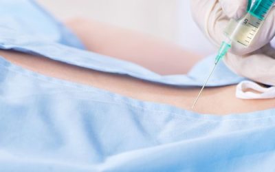 Facet Joint Injections