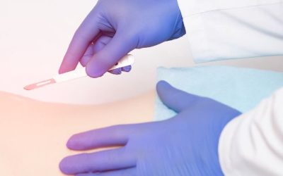 Spinal Cord Stimulation