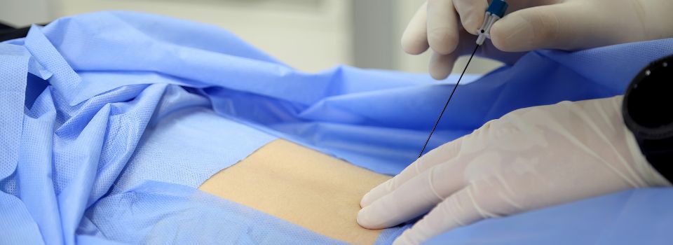 A person receiving a Lumbar Transforaminal Epidural Steroid Injection