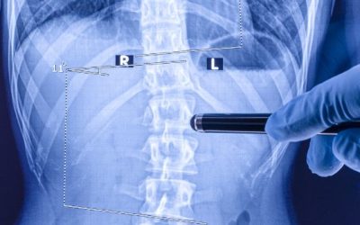 Lumbar Discography