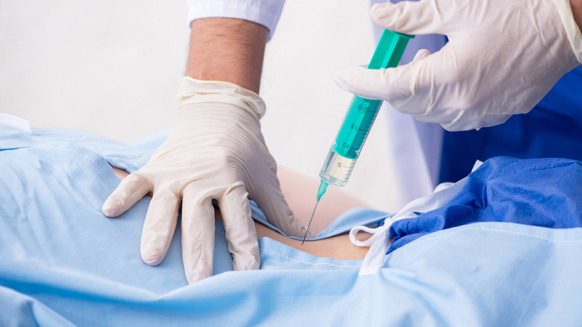 Intraforaminal Injection Lumbar Transforaminal Epidural Steroid Injection - Los Angeles ...
